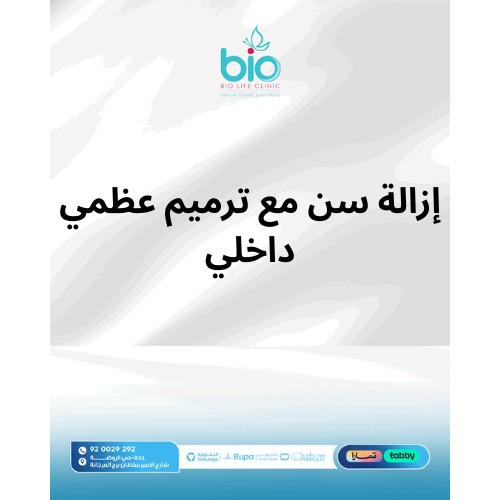 إزالة سن مع ترميم عظمي داخلي