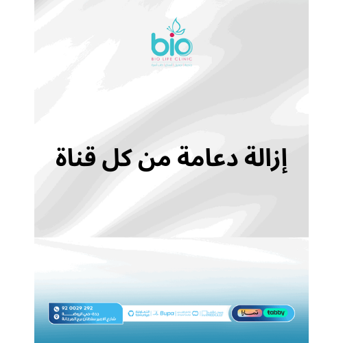 إزالة دعامة من كل قناة