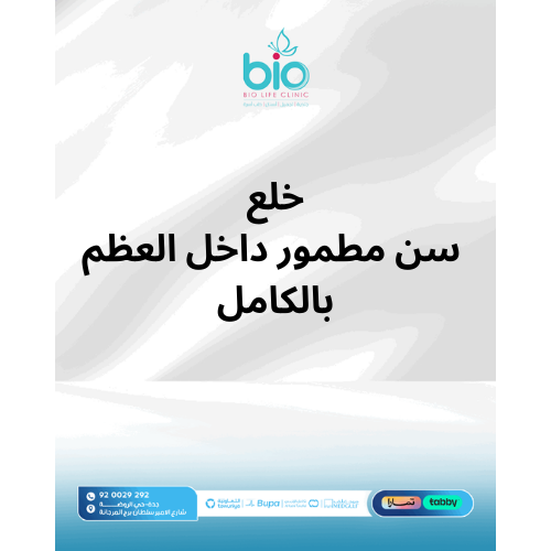 خلع سن مطمور داخل العظم بالكامل