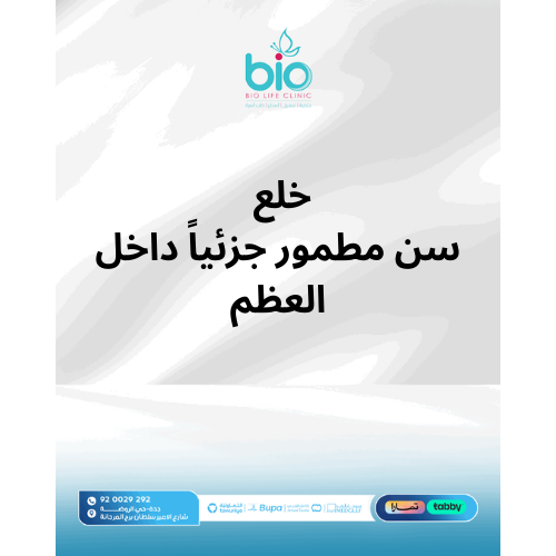 خلع سن مطمور جزئياً داخل العظم