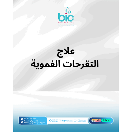 علاج التقرحات الفموية
