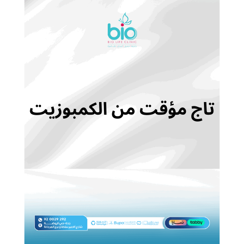 تاج مؤقت من الكمبوزيت