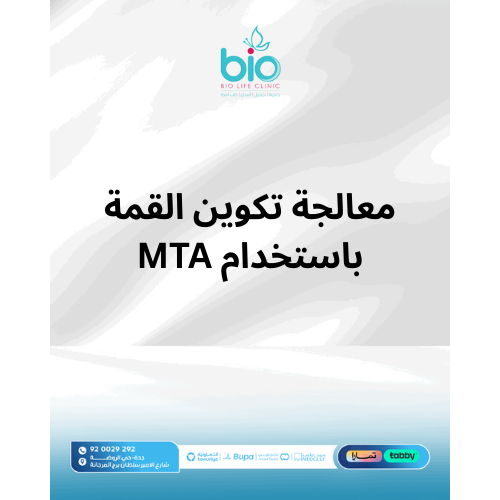 معالجة تكوين القمة باستخدام MTA
