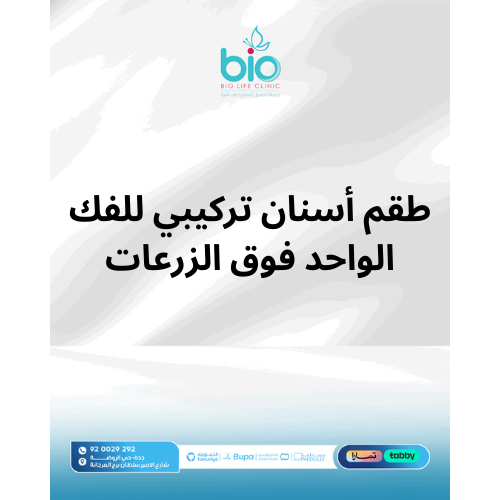 طقم أسنان تركيبي للفك الواحد فوق الزرعات