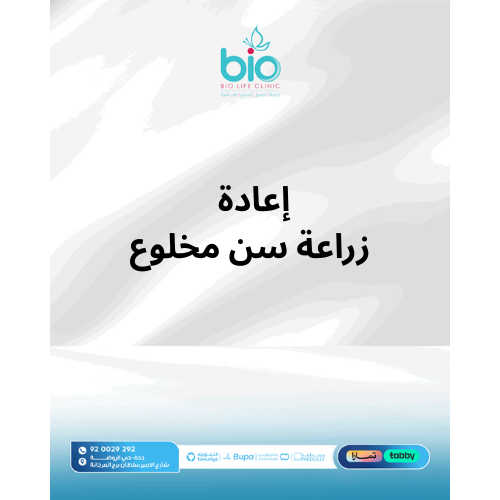إعادة زراعة سن مخلوع