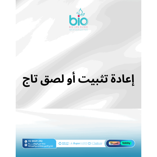 إعادة تثبيت أو لصق تاج
