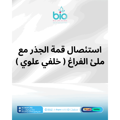 استئصال قمة الجذر مع ملئ الفراغ ( خلفي علوي )