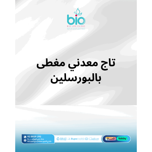 تاج معدني مغطى بالبورسلين